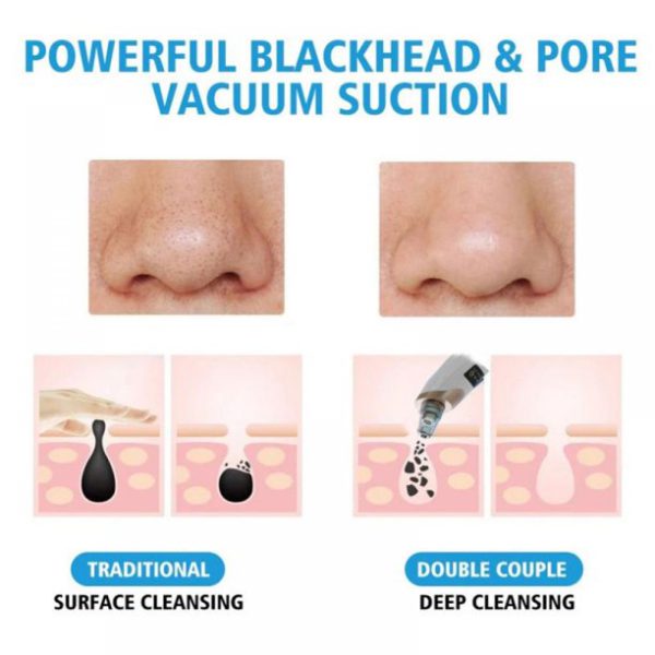 Blackhead Suction Remover Pore Vacuum| Blackhead Pore Cleaning Beauty Tool